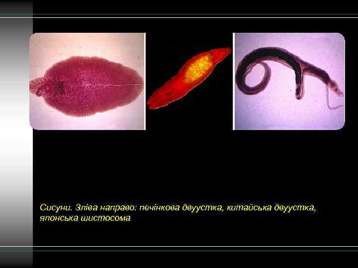 Сисуни. Зліва направо: печінкова двуустка, китайська двуустка, японська шистосома 