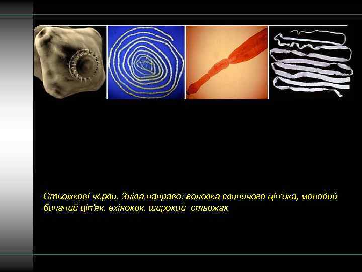 Стьожкові черви. Зліва направо: головка свинячого ціп'яка, молодий бичачий ціп'як, ехінокок, широкий стьожак 