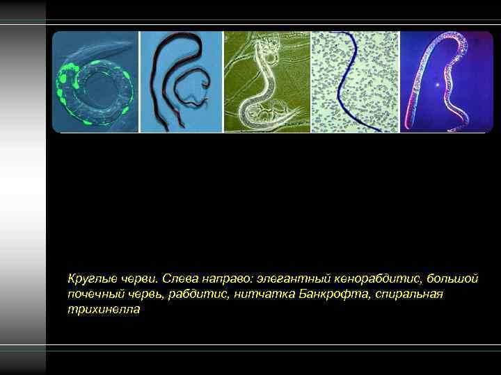 Круглые черви. Слева направо: элегантный кенорабдитис, большой почечный червь, рабдитис, нитчатка Банкрофта, спиральная трихинелла