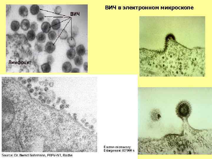 ВИЧ в электронном микроскопе 