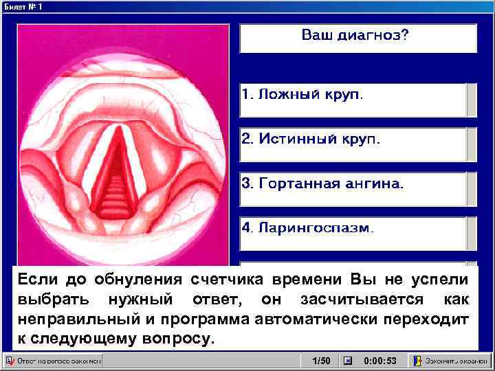 Ложный круп это. Истинный и ложный круп. Истинный круп развивается. Отличие ложного крупа от истинного. Истинный и ложный круп патанатомия.