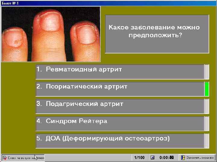 1/100 50 51 0: 00: 52 49 