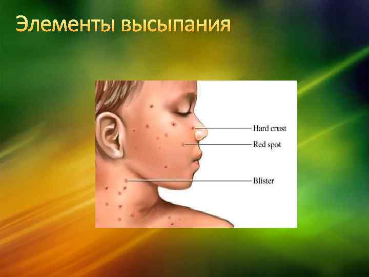 Элементы высыпания 
