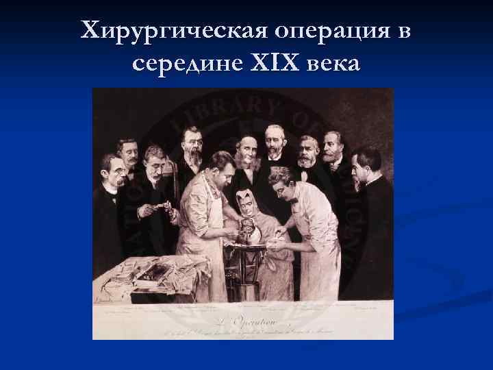 Хирургическая операция в середине XIX века 