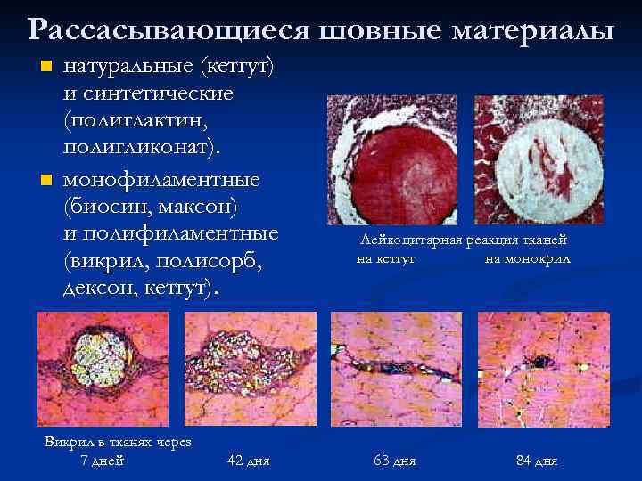 Рассасывающиеся шовные материалы n n натуральные (кетгут) и синтетические (полиглактин, полигликонат). монофиламентные (биосин, максон)