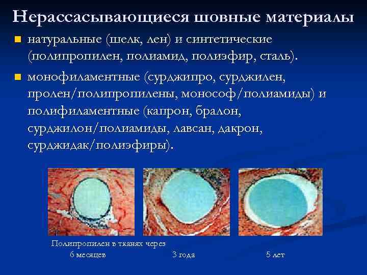 Нерассасывающиеся шовные материалы n n натуральные (шелк, лен) и синтетические (полипропилен, полиамид, полиэфир, сталь).