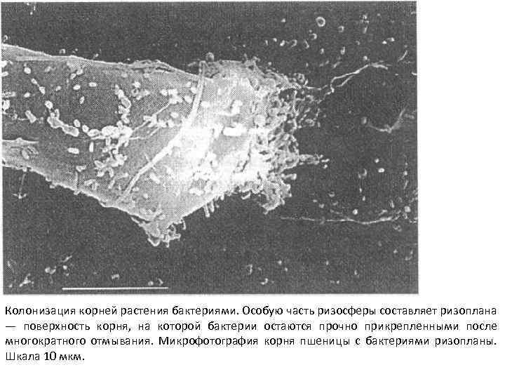 Колонизация корней растения бактериями. Особую часть ризосферы составляет ризоплана — поверхность корня, на которой