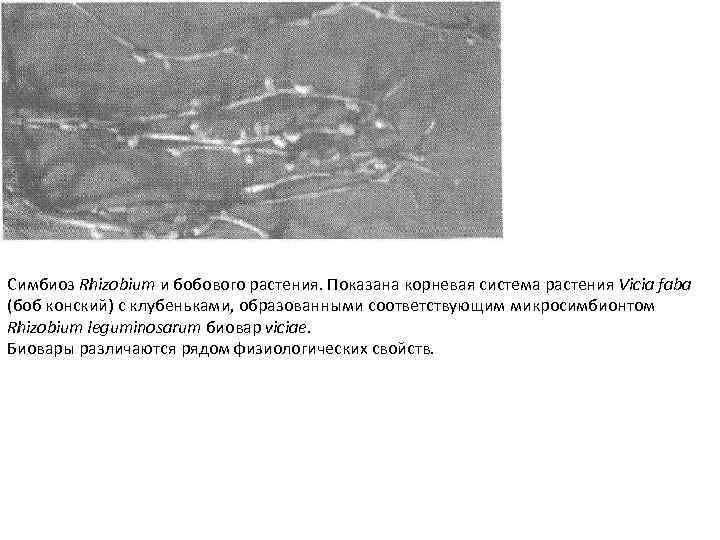 Симбиоз Rhizobium и бобового растения. Показана корневая система растения Vicia faba (боб конский) с