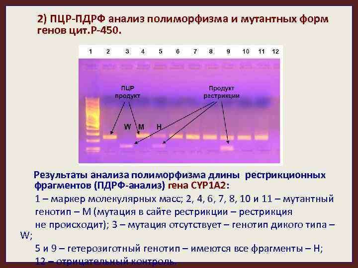 2) ПЦР-ПДРФ анализ полиморфизма и мутантных форм генов цит. Р-450. W; Результаты анализа полиморфизма