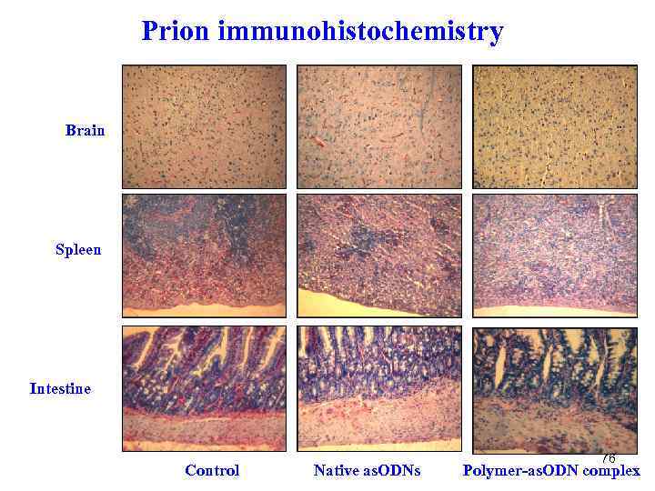Prion immunohistochemistry Brain Spleen Intestine Control Native as. ODNs 76 Polymer-as. ODN complex 