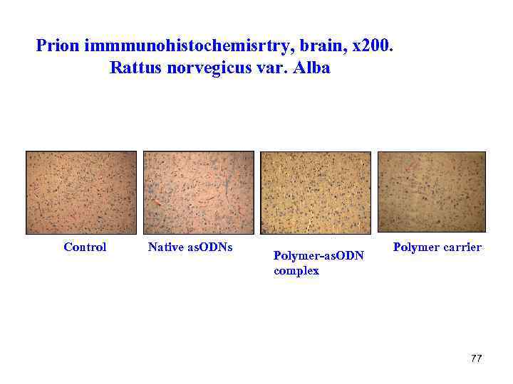 Prion immmunohistochemisrtry, brain, x 200. Rattus norvegicus var. Alba Control Native as. ODNs Polymer-as.