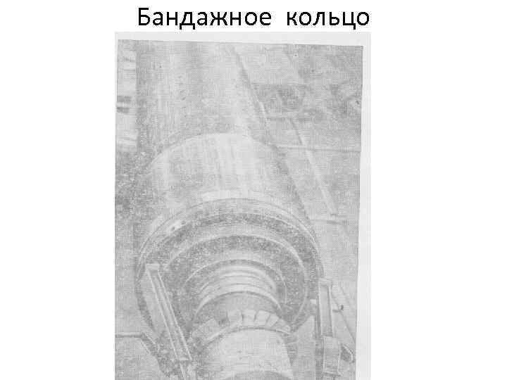 Бандажное кольцо 