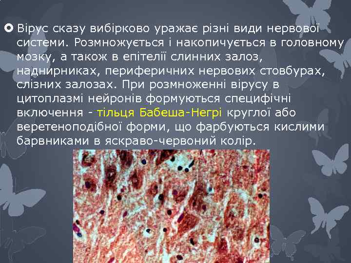  Вірус сказу вибірково уражає різні види нервової системи. Розмножується і накопичується в головному