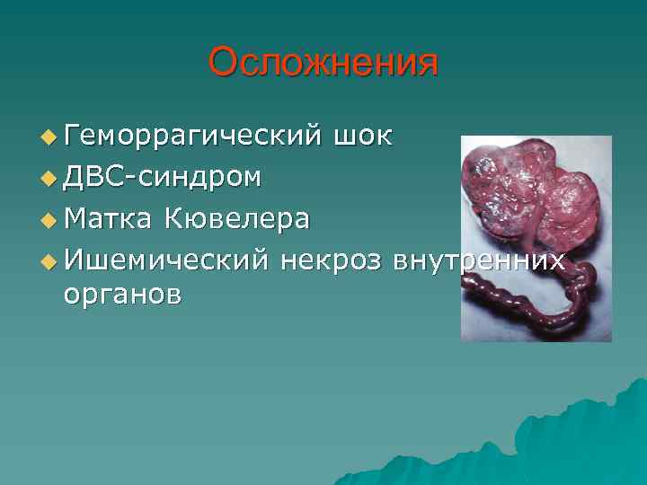 Осложнения u Геморрагический шок u ДВС-синдром u Матка Кювелера u Ишемический некроз внутренних органов