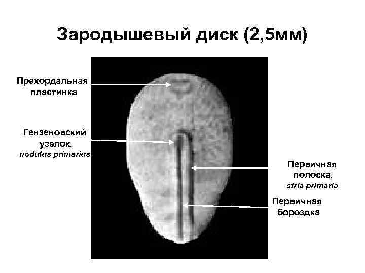 Зародышевый диск (2, 5 мм) Прехордальная пластинка Гензеновский узелок, nodulus primarius Первичная полоска, stria