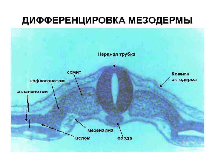ДИФФЕРЕНЦИРОВКА МЕЗОДЕРМЫ Нервная трубка сомит Кожная эктодерма нефрогонотом спланхнотом мезенхима целом хорда 
