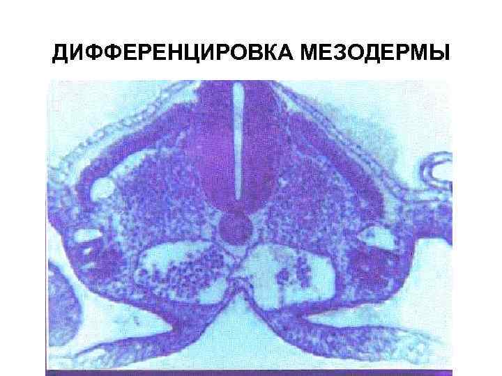 ДИФФЕРЕНЦИРОВКА МЕЗОДЕРМЫ 