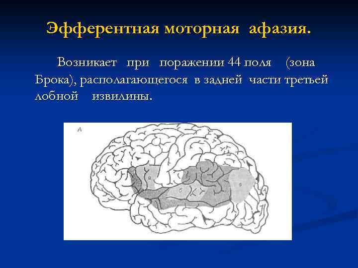 Характеристика афферентной моторной афазии