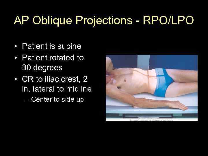 AP Oblique Projections - RPO/LPO • Patient is supine • Patient rotated to 30