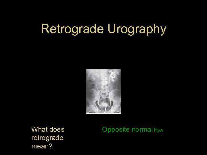 Retrograde Urography What does retrograde mean? Opposite normal flow 