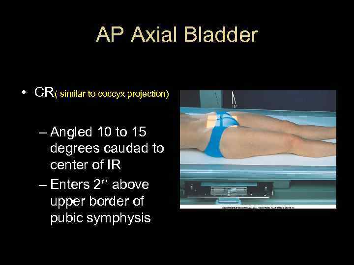 AP Axial Bladder • CR( similar to coccyx projection) – Angled 10 to 15