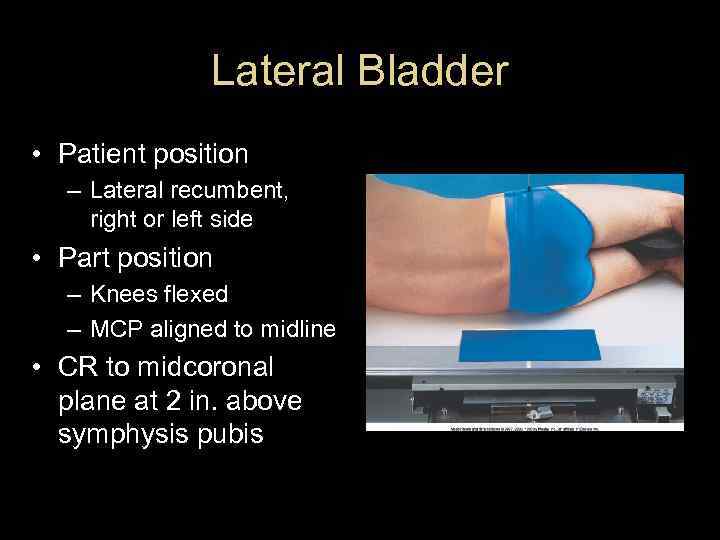 Lateral Bladder • Patient position – Lateral recumbent, right or left side • Part