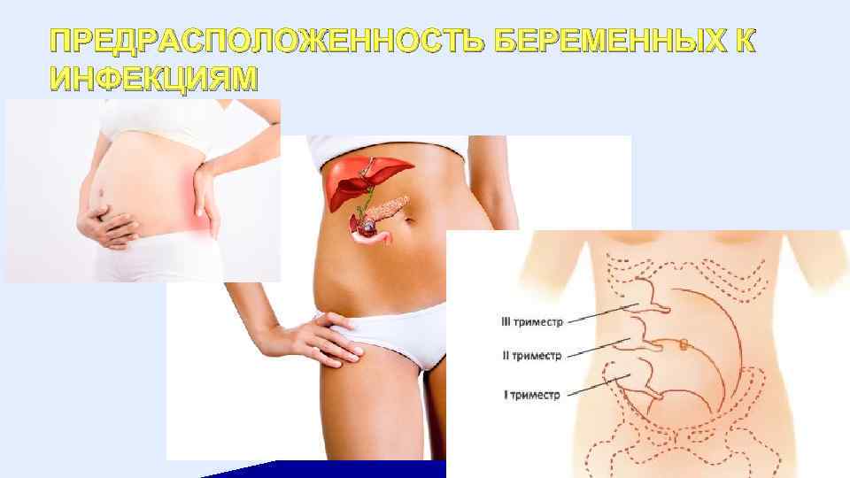 ПРЕДРАСПОЛОЖЕННОСТЬ БЕРЕМЕННЫХ К ИНФЕКЦИЯМ 