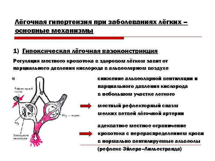 Лёгочная гипертензия при заболеваниях лёгких – основные механизмы 1) Гипоксическая лёгочная вазоконстрикция Регуляция местного