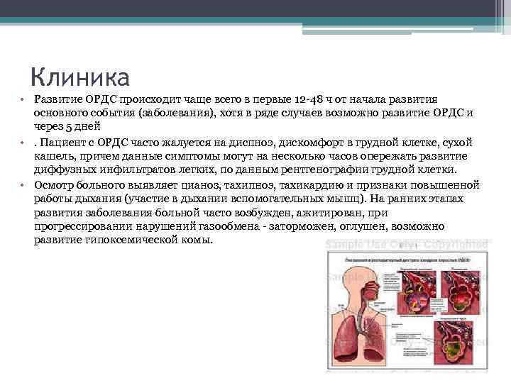 Клиника • Развитие ОРДС происходит чаще всего в первые 12 -48 ч от начала