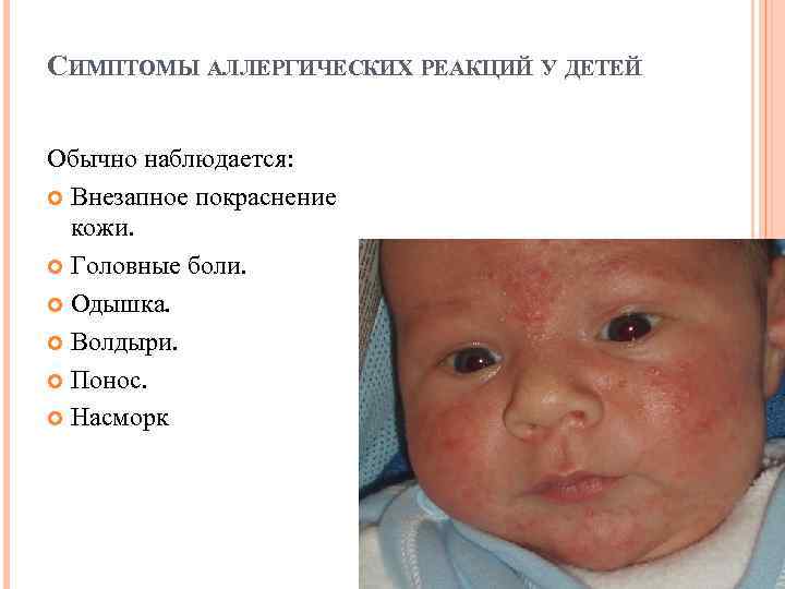 СИМПТОМЫ АЛЛЕРГИЧЕСКИХ РЕАКЦИЙ У ДЕТЕЙ Обычно наблюдается: Внезапное покраснение кожи. Головные боли. Одышка. Волдыри.