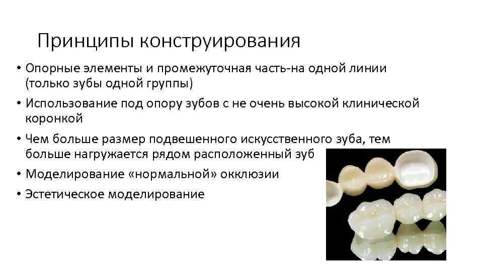 Принципы конструирования • Опорные элементы и промежуточная часть-на одной линии (только зубы одной группы)