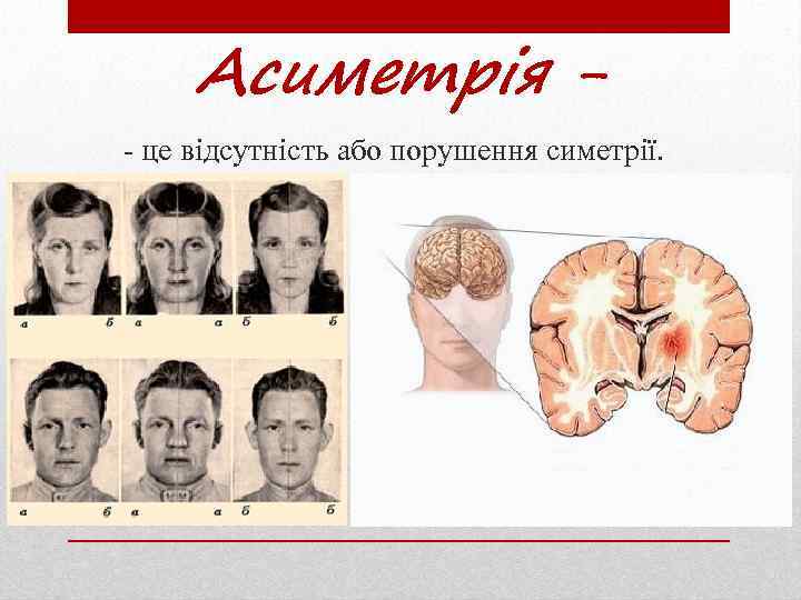Асиметрія - це відсутність або порушення симетрії. 