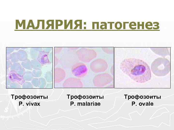 МАЛЯРИЯ: патогенез Трофозоиты Р. vivax Трофозоиты Р. malariae Трофозоиты Р. ovale 