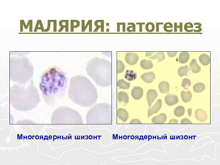 МАЛЯРИЯ: патогенез Многоядерный шизонт 