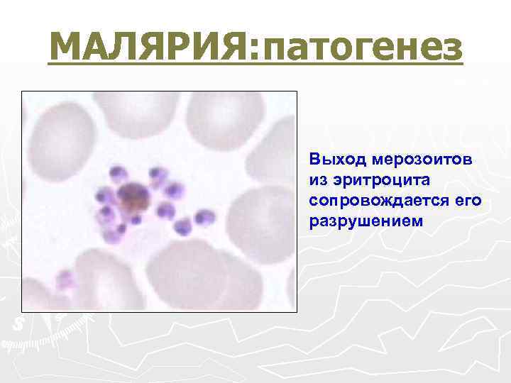 МАЛЯРИЯ: патогенез Выход мерозоитов из эритроцита сопровождается его разрушением 