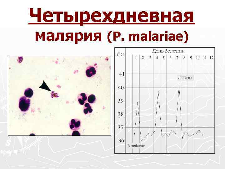 Четырехдневная малярия (P. malariae) 
