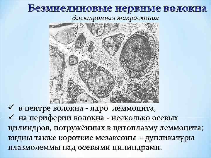 Электронная микроскопия ü в центре волокна - ядро леммоцита, ü на периферии волокна -