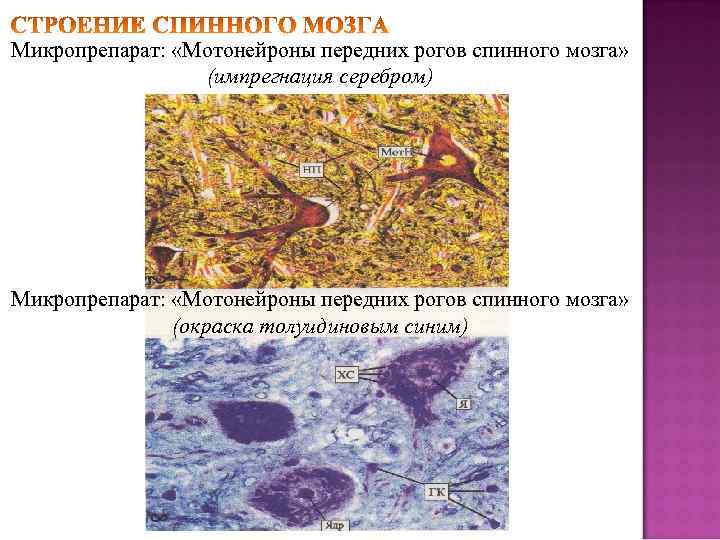 Микропрепарат: «Мотонейроны передних рогов спинного мозга» (импрегнация серебром) Микропрепарат: «Мотонейроны передних рогов спинного мозга»
