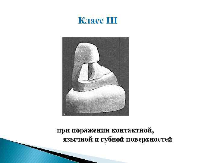 Класс III при поражении контактной, язычной и губной поверхностей 