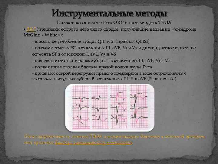 Инструментальные методы Позволяются исключить ОКС и подтвердить ТЭЛА ▪ ЭКГ (признаки острого легочного сердца,