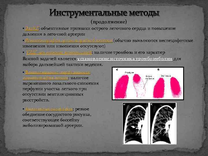 Инструментальные методы (продолжение) ▪ Эхо. КГ: объективные признаки острого легочного сердца и повышение Эхо.