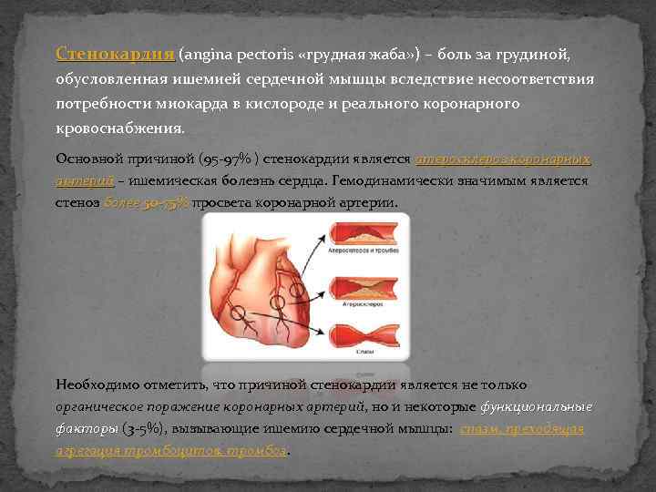 Стенокардия (angina pectoris «грудная жаба» ) – боль за грудиной, обусловленная ишемией сердечной мышцы