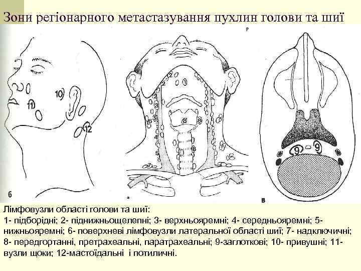 Зони регіонарного метастазування пухлин голови та шиї Лімфовузли області голови та шиї: 1 -