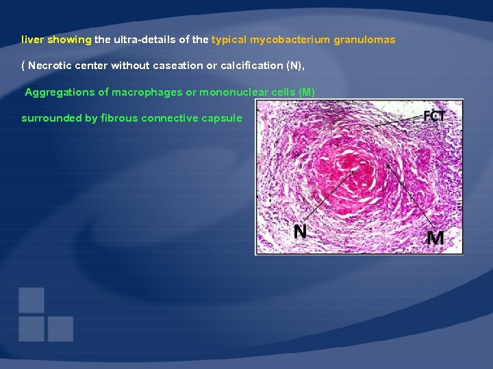 liver showing the ultra-details of the typical mycobacterium granulomas ( Necrotic center without caseation