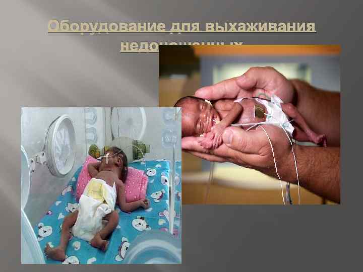 Оборудование для выхаживания недоношенных 