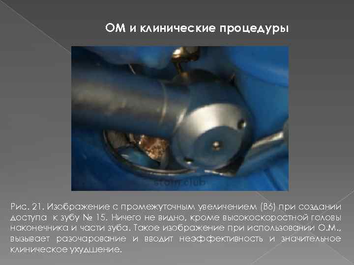 ОМ и клинические процедуры Рис. 21. Изображение с промежуточным увеличением (В 6) при создании