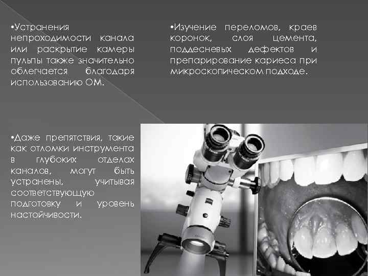  • Устранения непроходимости канала или раскрытие камеры пульпы также значительно облегчается благодаря использованию
