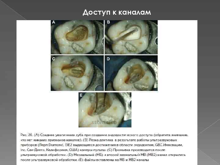 Доступ к каналам 