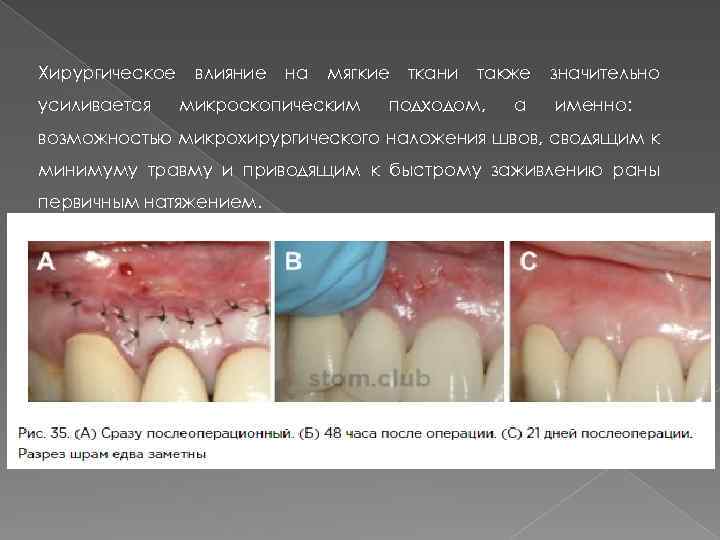 Хирургическое усиливается влияние на мягкие микроскопическим ткани также подходом, а значительно именно: возможностью микрохирургического