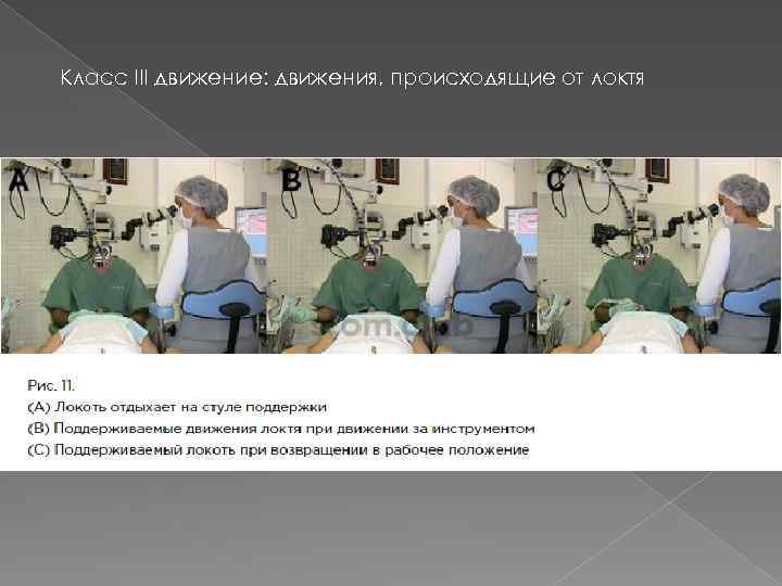 Класс III движение: движения, происходящие от локтя 